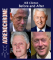 Bill Clinton before and after.png